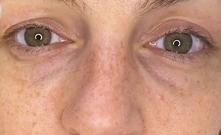 Патчі навколо очей Sesderma C-Vit Eye Contour Patches, 5 шт. Патчі навколо очей Sesderma C-Vit Eye Contour Patches, 5 шт.