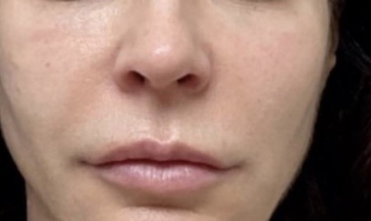 Ревіталізуючий крем-гель з вітаміном C для обличчя Sesderma C-Vit Revitalizing Cream Gel 50 мл Ревіталізуючий крем-гель з вітаміном C для обличчя Sesderma C-Vit Revitalizing Cream Gel 50 мл