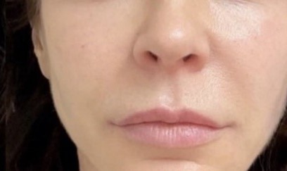 Ревіталізуючий крем-гель з вітаміном C для обличчя Sesderma C-Vit Revitalizing Cream Gel 50 мл Ревіталізуючий крем-гель з вітаміном C для обличчя Sesderma C-Vit Revitalizing Cream Gel 50 мл