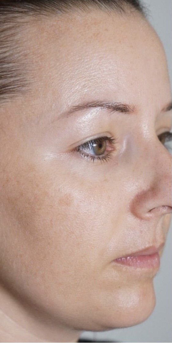 Двофазна сироватка з вітаміном С для сяйва та зволоження Sesderma C-Vit Radiance Serum 5 x 7 мл Двофазна сироватка з вітаміном С для сяйва та зволоження Sesderma C-Vit Radiance Serum 5 x 7 мл