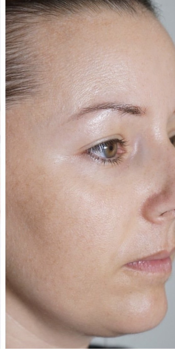 Двофазна сироватка з вітаміном С для сяйва та зволоження Sesderma C-Vit Radiance Serum 5 x 7 мл Двофазна сироватка з вітаміном С для сяйва та зволоження Sesderma C-Vit Radiance Serum 5 x 7 мл
